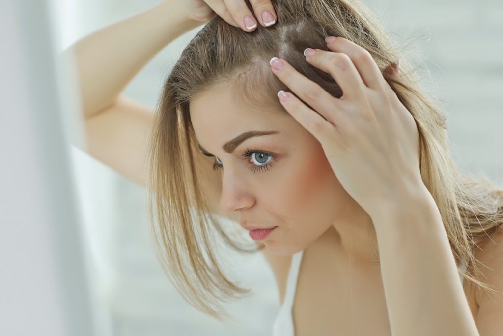 Are You Still Struggling with Hair Loss